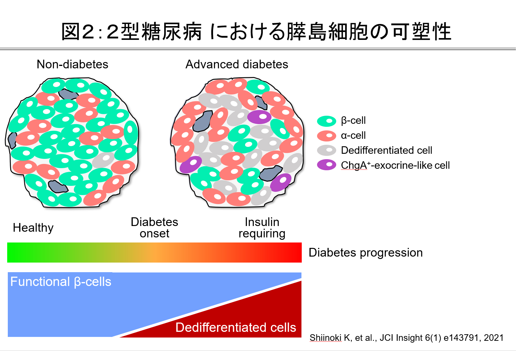 ２：２型糖尿病 における膵島細胞の可塑性